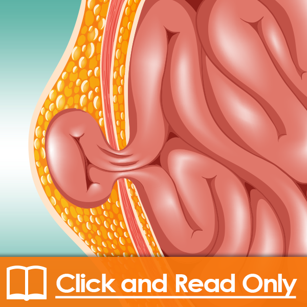 Hernia of the Abdomen and Groin – Click and Read (Florida CNA approved) – 2.5 CE/Contact Hours